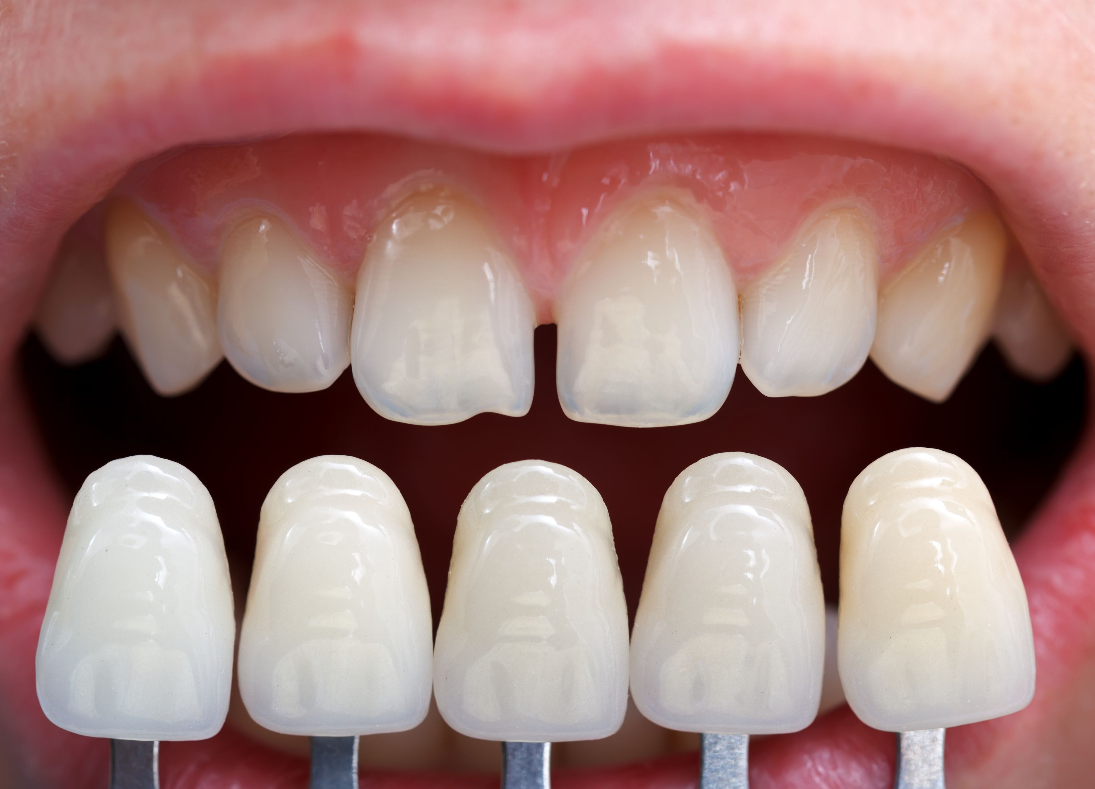 Where can I find a Cosmetic Dentist in San Mateo?