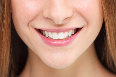 Palm Beach Gardens Teeth Whitening