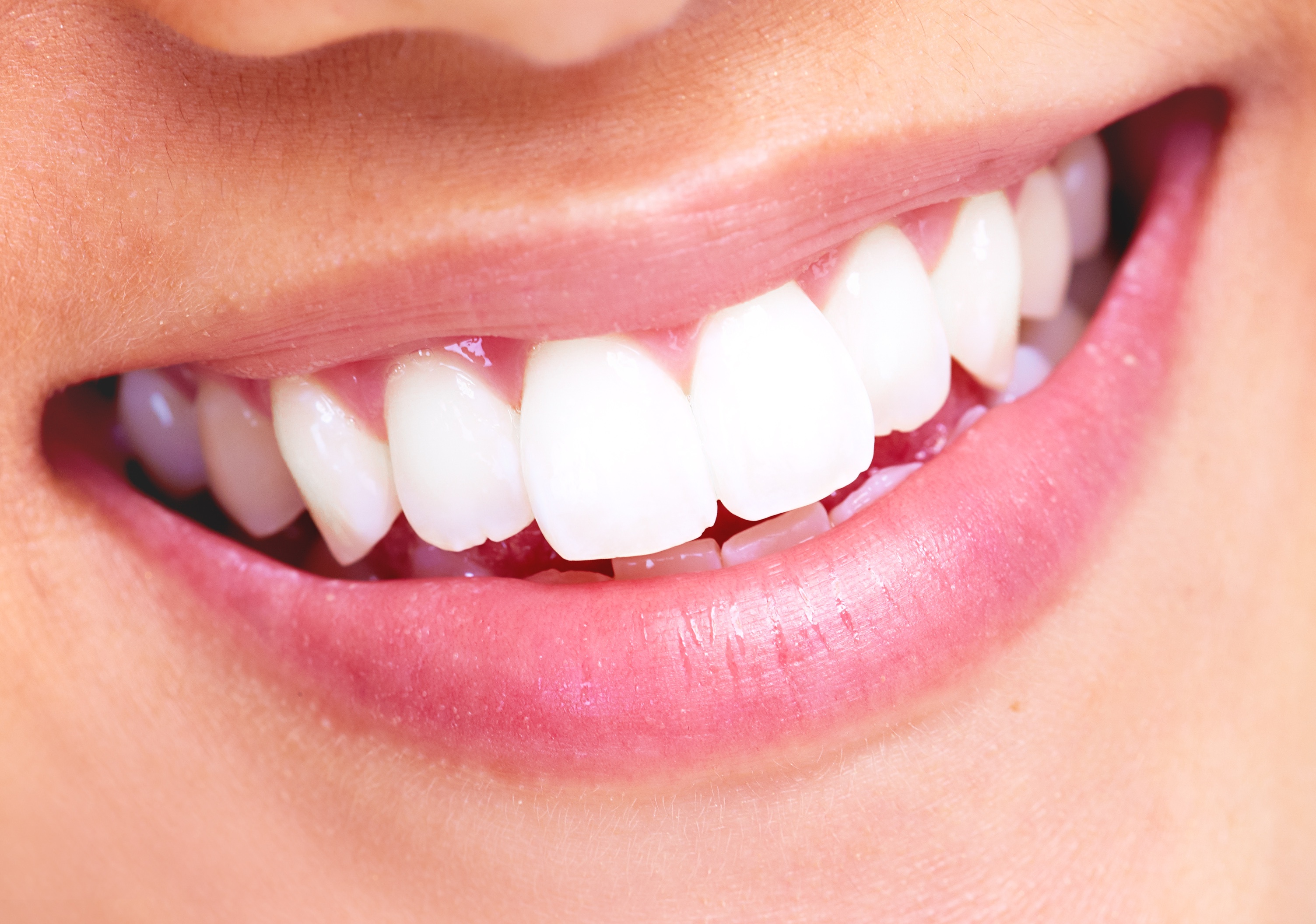 Garden City teeth whitening