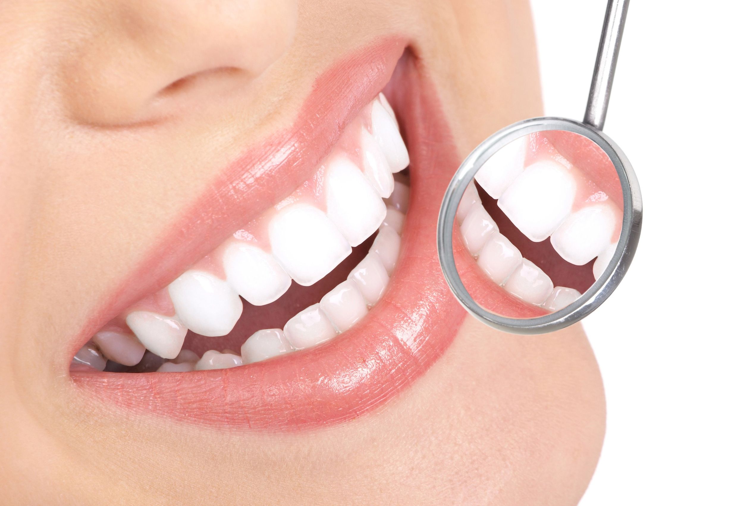 Teeth Cleaning in Concord
