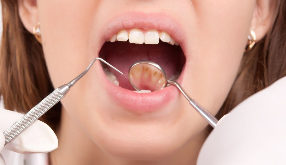 Naperville Root Canal Therapy