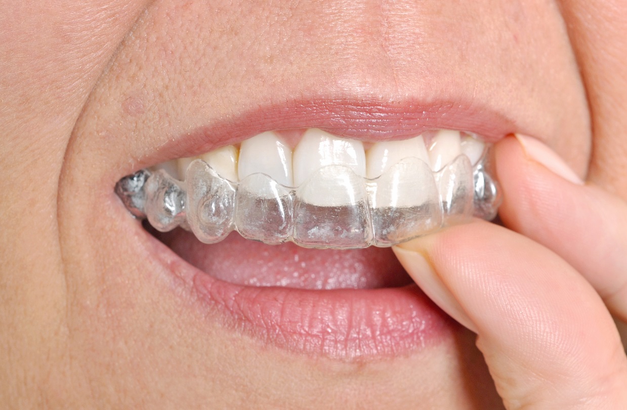 Invisalign Palmdale