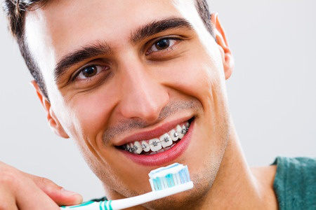 Teeth cleaning Palmdale