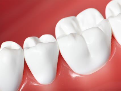 Dental Excellence | Crowns & Caps, Dental Bridges and All-on-6®