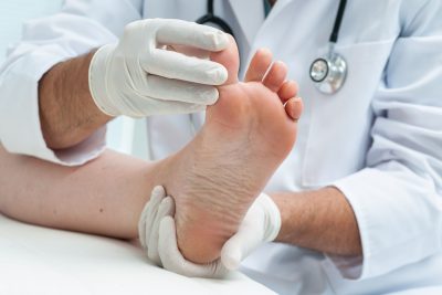 Bunion Doctor in Springdale