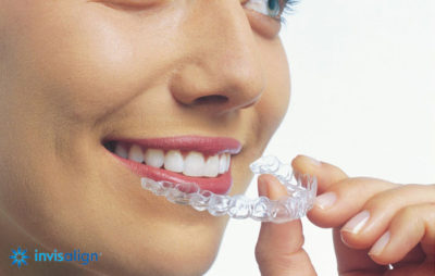 West Hartford CT Invisalign