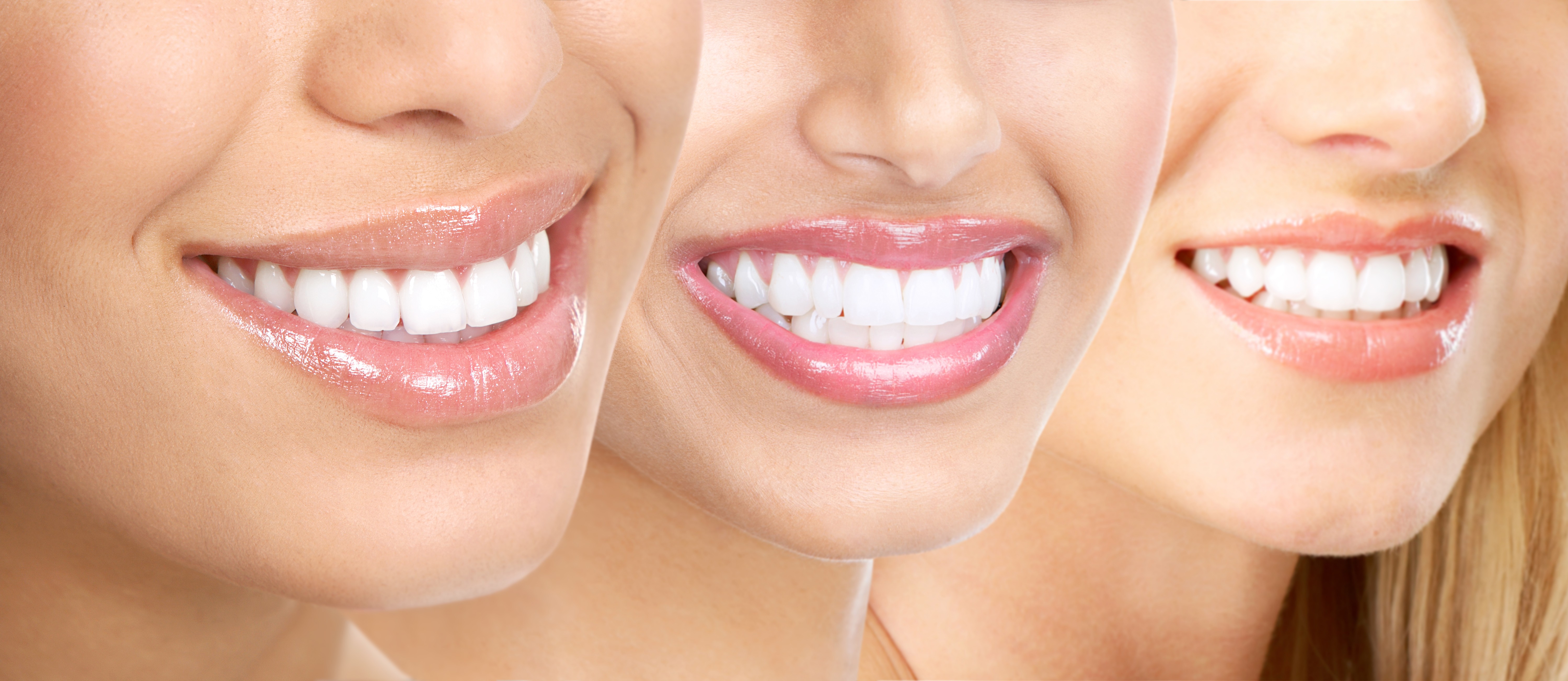 Teeth Whitening in Suffern