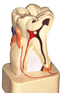 Bring Decayed or Damaged Teeth Back from the Brink with Root Canal Therapy in Charlotte, NC