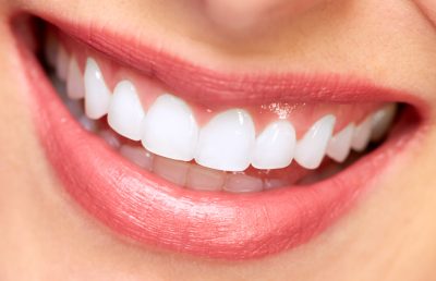 Teeth Whitening in North Haven