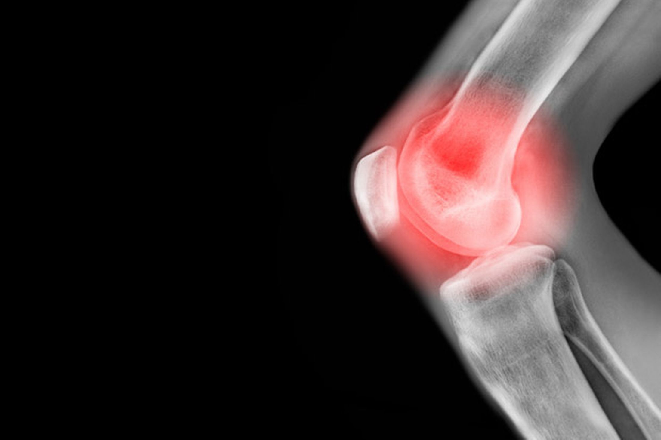Henderson Knee Pain Treatment